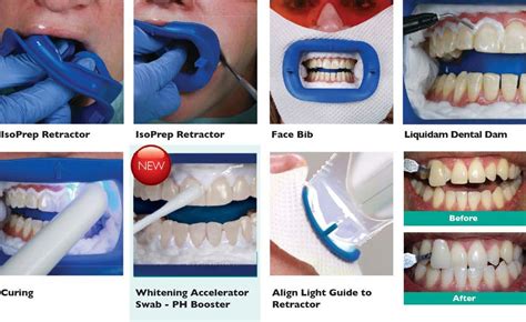 Enhance your confidence with magic white teeth whitening
